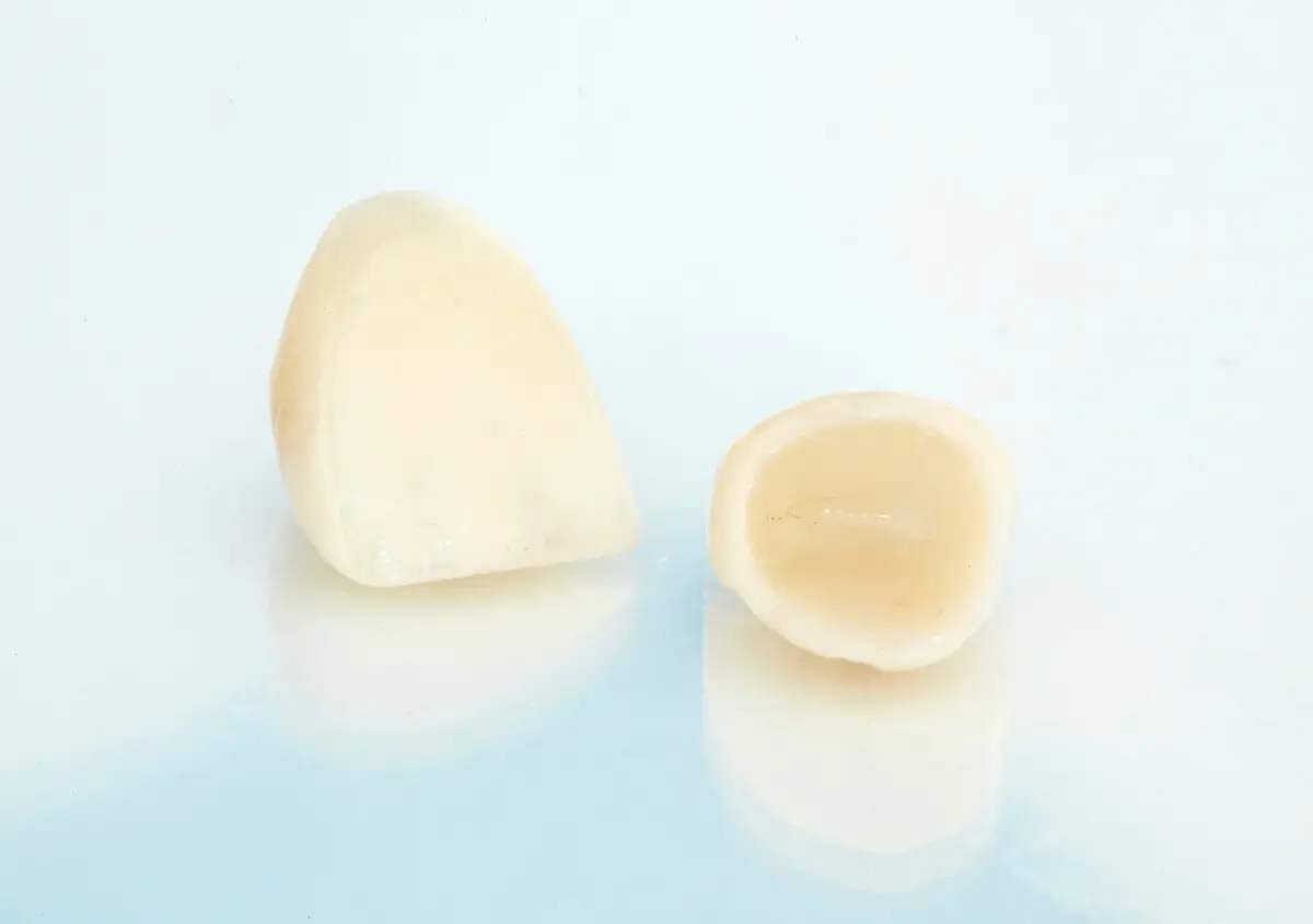 Preparing for a Crown Procedure: A Comprehensive Guide