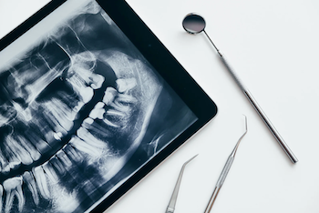 The Importance of Regular Dental Checkups – Dental Care In Newnan, GA