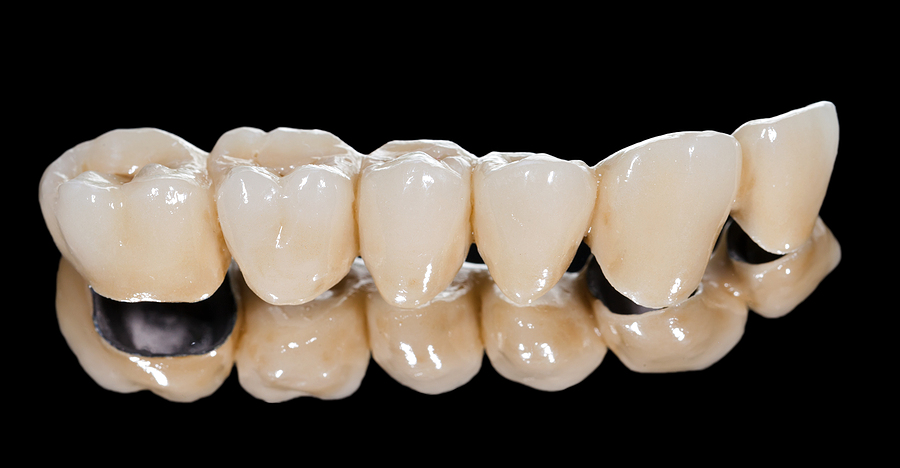 Restoring Your Smile with Dental Bridges in Newnan, GA
