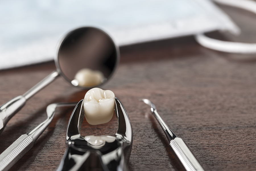 Everything You Need to Know About Tooth Extraction in Newnan, GA